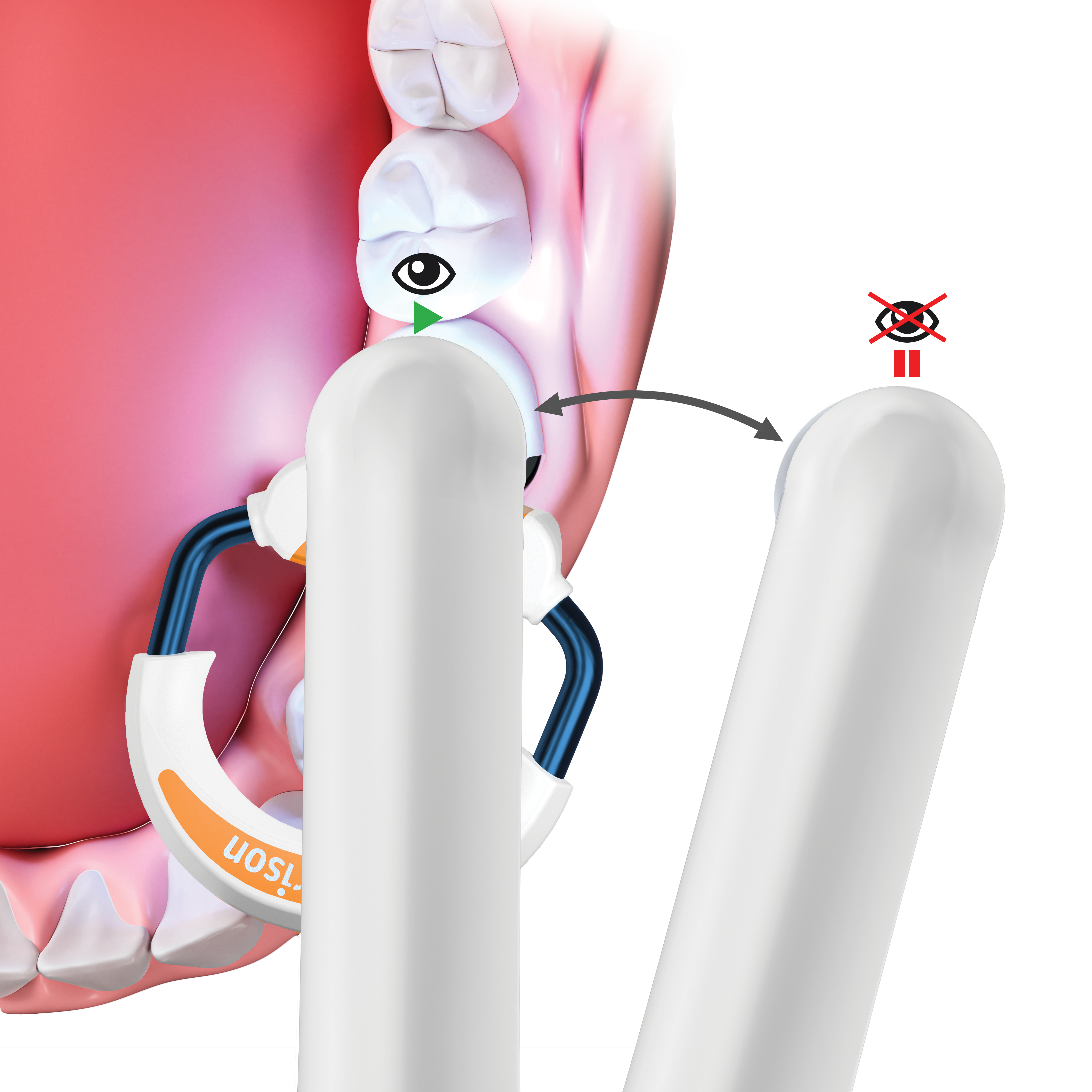 AccuStart - Loop LED Curing Light