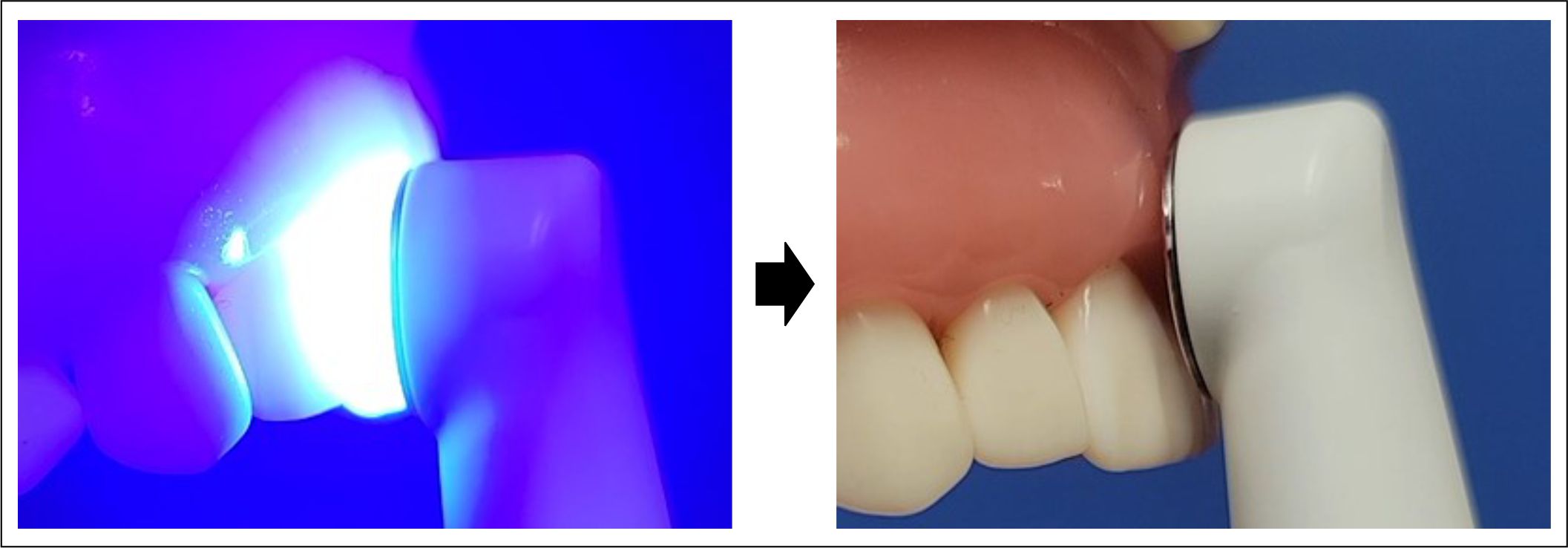  Figure 11 - Safety gums.jpg 