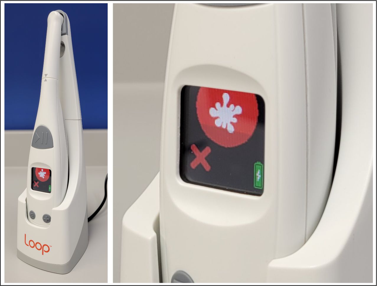  Figure 12 - Loop debris indicator.jpg 