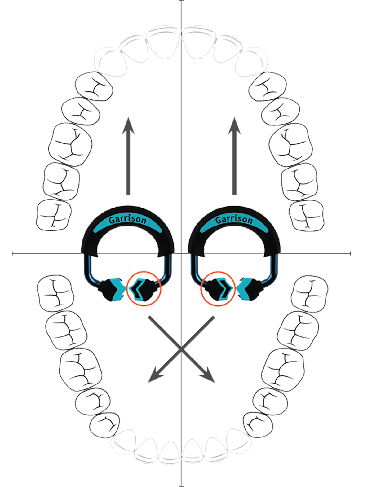 Quad Rings with Red Circles Inside Full Mouth Photo Large