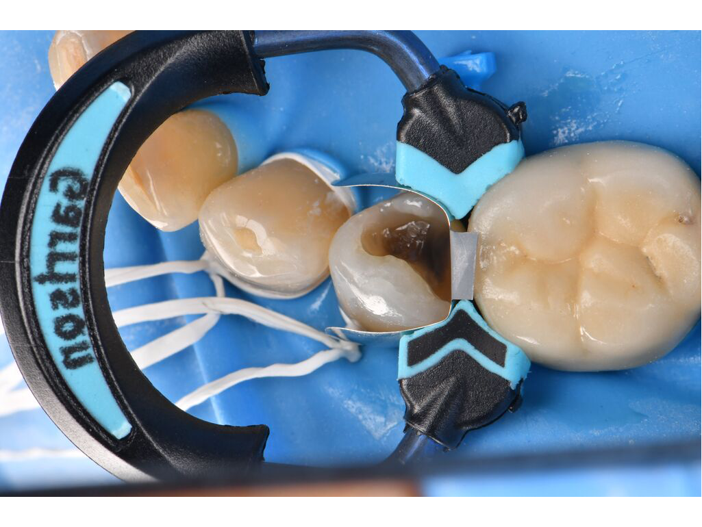 Quad case Resource Center 2