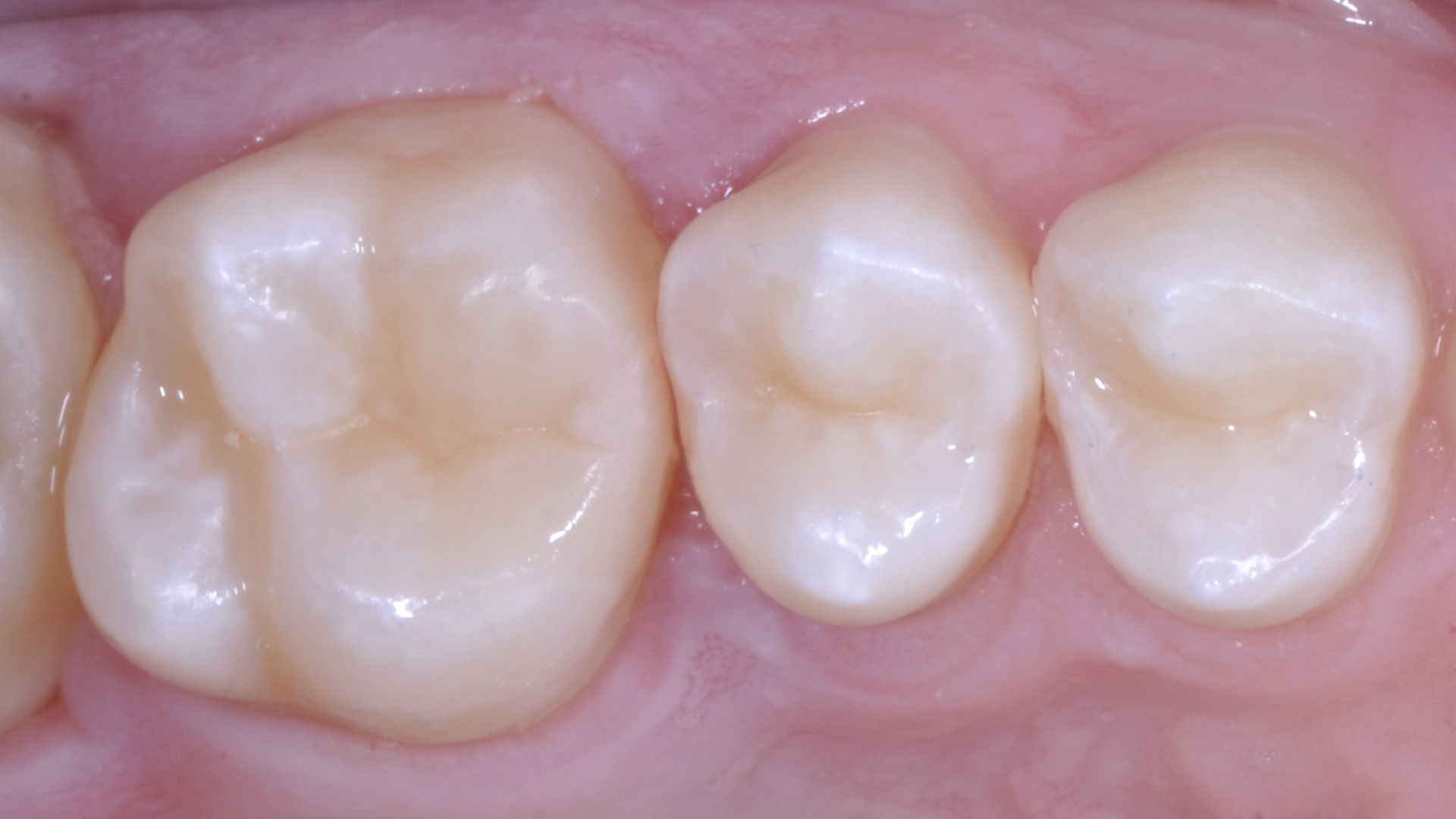 VincenzoAttanasio_010_05072023 Figure 10
